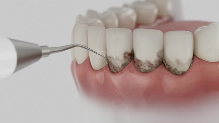 Reliable Emergency Dentist contractor in Bellmore, NY by Smile Center Dentistry